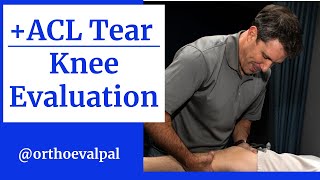 Knee Evaluation of Patient with an ACL Tear!