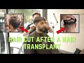 Cutting my Hair After 2 Hair Transplants (10k Grafts)