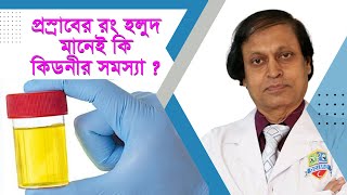 প্রস্রাবের রং হলুদ মানেই কি কিডনীর সমস্যা ? হাসপাতাল