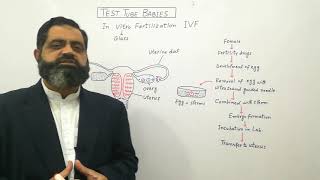 Test tube babies Urdu /Hindi medium @prof.masoodfuzail| In Vitro Fertilization | IVF |