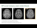 1.4 Основи нейрорадіології Частина 3