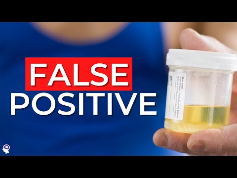 Can metronidazole cause false positive drug test?