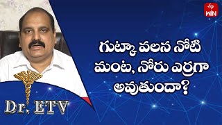 గుట్కా వలన నోటి మంట, నోరు ఎర్రగా అవుతుందా?|డాక్టర్ ఈటీవీ | 9th ఆగస్టు 2023 | ఈటీవీ  లైఫ్