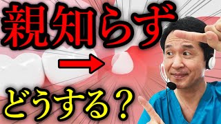 【親知らずの対処法】抜歯or 温存？│歯医者が解説