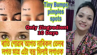 Say Goodbye to Skin Issues in 10 Days..ৰাতি শোৱাৰ আগত লগাই ৰাতিপুৱা উঠি আচৰিত হব..2 ingredients Only