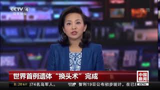 世界首例遗体“换头术”完成 中国专家参与指导 耗时18小时