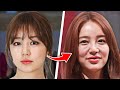 12 Korean Actors Before and After Plastic Surgery