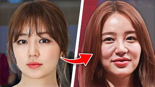12 Korean Actors Before And After Plastic Surgery