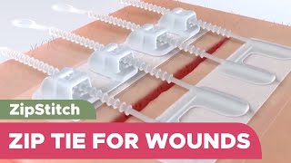 When you can't Stitch it, Zip it: Suture-Less bandage to close wounds