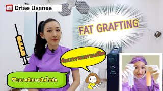 ฉีดไขมันหน้าเด็ก Fat grafting เทรนด์ศัลยกรรมเกาหลีที่มาแรง ใครจะทำต้องดูคลิปนี้ก่อนเรย