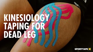 Kinesiology Taping for Dead Leg - How To Use Kinesiology Tape to Reduce Swelling \u0026 Haematoma