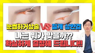 [닥터플래너 tv] 눈썹하거상술 VS 절개 상안검 나에게는 뭐가 맞을지 모르시겠다고요? 닥터 L 원장이 확실하게 결정해 드립니다!!!