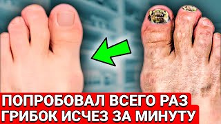 Мало КТО Знает! УНИЧТОЖАЕТ Самый Ужасный и Запущенный Грибок