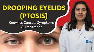 Ptosis Explained: Causes, Symptoms, and How to Fix Drooping Eyes #ptosiscorrection