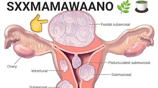 KA FIIRSADA QALIINKA BUROOYINKA MAKAANKA GAAR AHAAN BUROOYINKA WAA WEEYN WAA LALA TUURAA MAR MAR