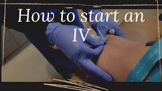 How to start an IV