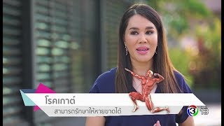 Health Society | จริงหรือไม่กินไก่มาก เป็นโรคเกาต์ | 12-08-60 | Ch3Thailand