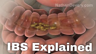 What is irritable bowel syndrome? IBS explained.