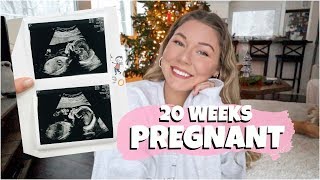 20 WEEK PREGNANCY UPDATE! // Ultrasound Talk + Why We Can't Travel