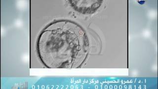#الطبيب: د. عمرو الحسيني تطور تكنولوجيا الحقن المجهري والاخصاب وظهور تكنولوجيا الحقن بالليزر