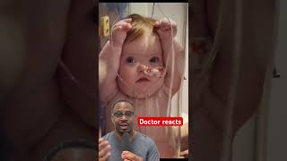 Doctor explains how infant X-rays are taken #shorts #medical