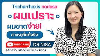 ผมเปราะ - ผมขาดง่าย (Trichorrhexis nodosa)