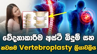 වේදනාකාරීම අස්ථි බිදුම් සහ නවතම Vertebroplasty ක්‍රියාවලිය