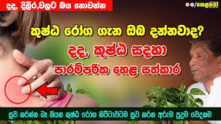 දද, කුෂ්ඨ සදහා පාරම්පරික හෙළ සත්කාර | Treatments for Eczema Sinhala