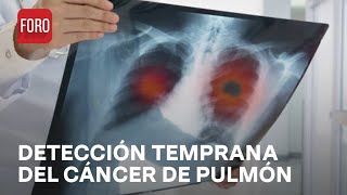 Causas y síntomas del cáncer de pulmón - Las Noticias