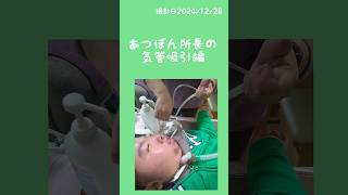 くらしケア⑤【気管吸引編】 #医療的ケア児 #あつぼん所長#医療的ケア#手順 #喀痰吸引#人工呼吸器