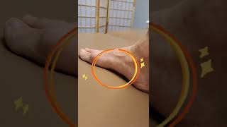 Pain at the arches? This will help your #plantarfasciitis!!