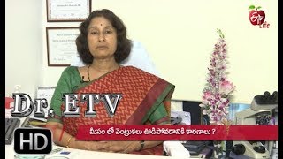 Alopecia Areata | Dr ETV | 6th  May 2019 | ETV Life