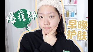 春季混油痘肌日常护理routine ｜ 爆痘期早间\u0026晚间护肤推荐！