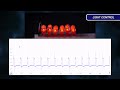 Pulse Width Modulation Explained