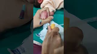 #shorts  Taking Venous blood sample in Newborn