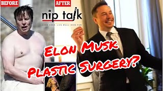 Did Elon Musk Get Plastic Surgery?