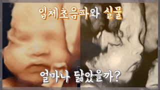 [육아]입체초음파와 실물 전격 비교!!!