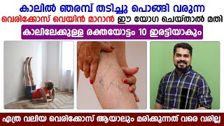 വെരികോസ് വെയ്ൻ മാറാൻ ഈ യോഗ ചെയ്‌താൽ മതി| vericose vein treatment