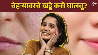 How To Treat Open Pores | Open Pores Treatment | Products For Open Pores | Urmila Nimbalkar