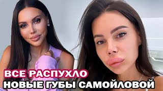 Жена Джигана шокировала подписчиков! Новые губы Оксаны Самойловой