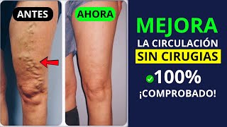 Como tener CIRCULACIÓN PERFECTA sin CIRUGÍAS 100% Natural✅