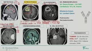 Neurología - Tumores 2