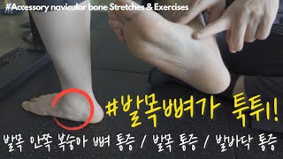 발목 안쪽, 발바닥, 뒤꿈치 통증 확실히 낫게 해드립니다!(부주상골증후군)(Best Accessory navicular bone Stretches & Exercises)