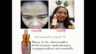 รีวิวเซรั่มน้ำมันบำรุงผิว Gold Therapy Serum in Oil น้ำมันเมล็ดทับทิม