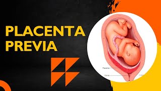 Placenta Previa / APH / obstetrics and gynaecology