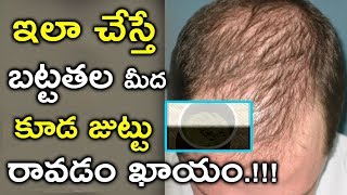 ఇలా చేస్తే బట్టతల మీద కూడా జుట్టు రావటం ఖాయం | Top Tips to Care for a Bald Head | 2 MINUTES TIPS