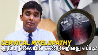 Cervical Myelopathy ஆரம்ப நிலையில் கண்டுஅறிவது எப்படி?