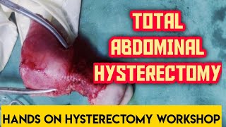 Total Abdominal Hysterectomy- Hands on Hysterectomy Work shop