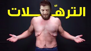 كيف تخلصت من الجلد الزائد بعد نزول وزني 60 كيلو