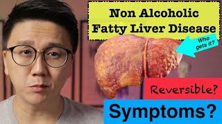 NAFLD/NASH Symptoms | How to Reverse Fatty Liver Disease